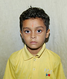 Dev